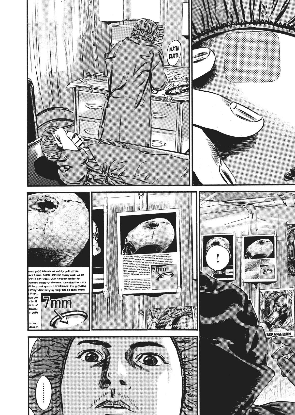 Homunculus Chapter 7 - Page 314